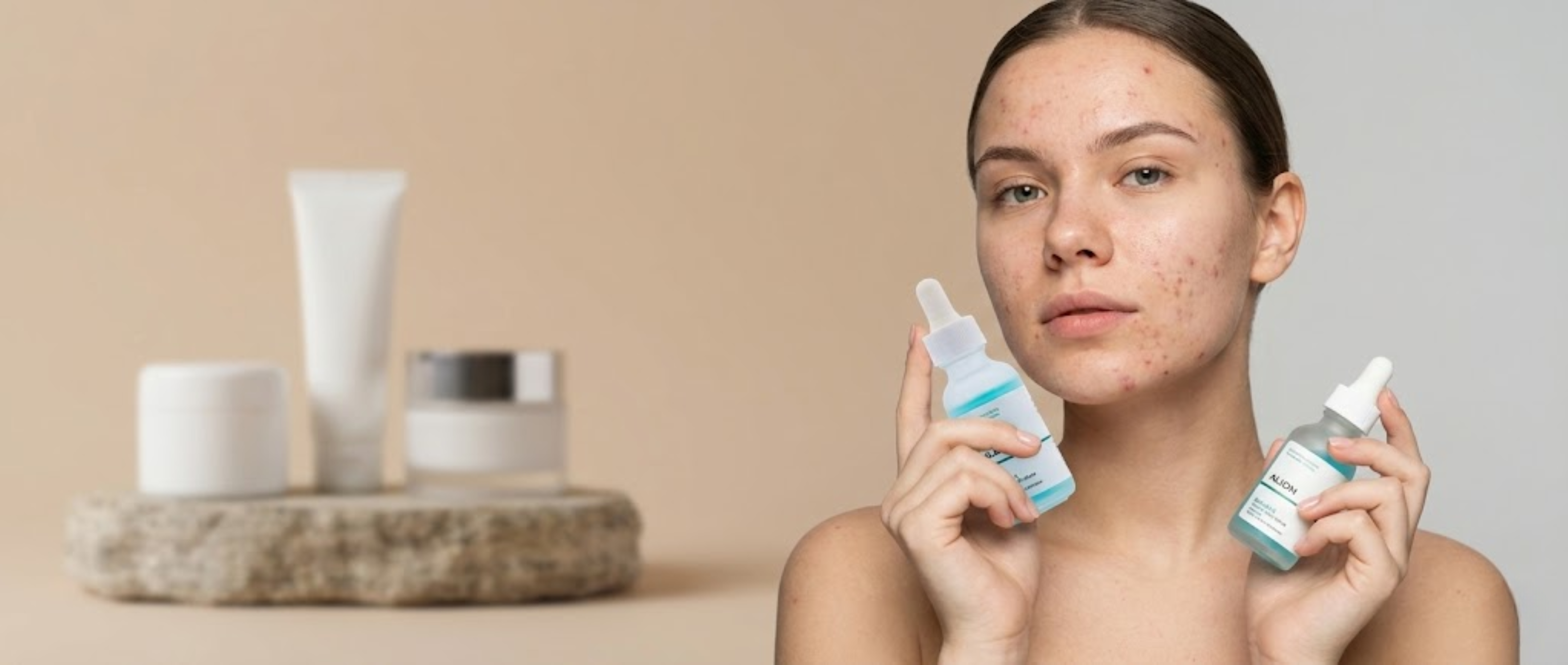 Image of Acne-Prone Skin