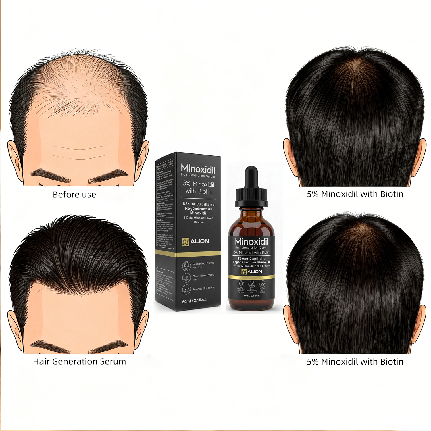Image of Minoxidil